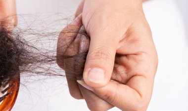 Causes Of Hair Loss, Homeopathic Remedies For Hair fall